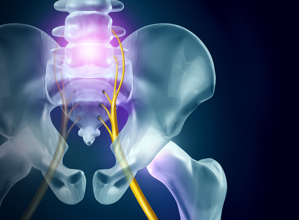 Sciatica Pain Relief - Anatomy & Definition — Revive Sport & Spine
